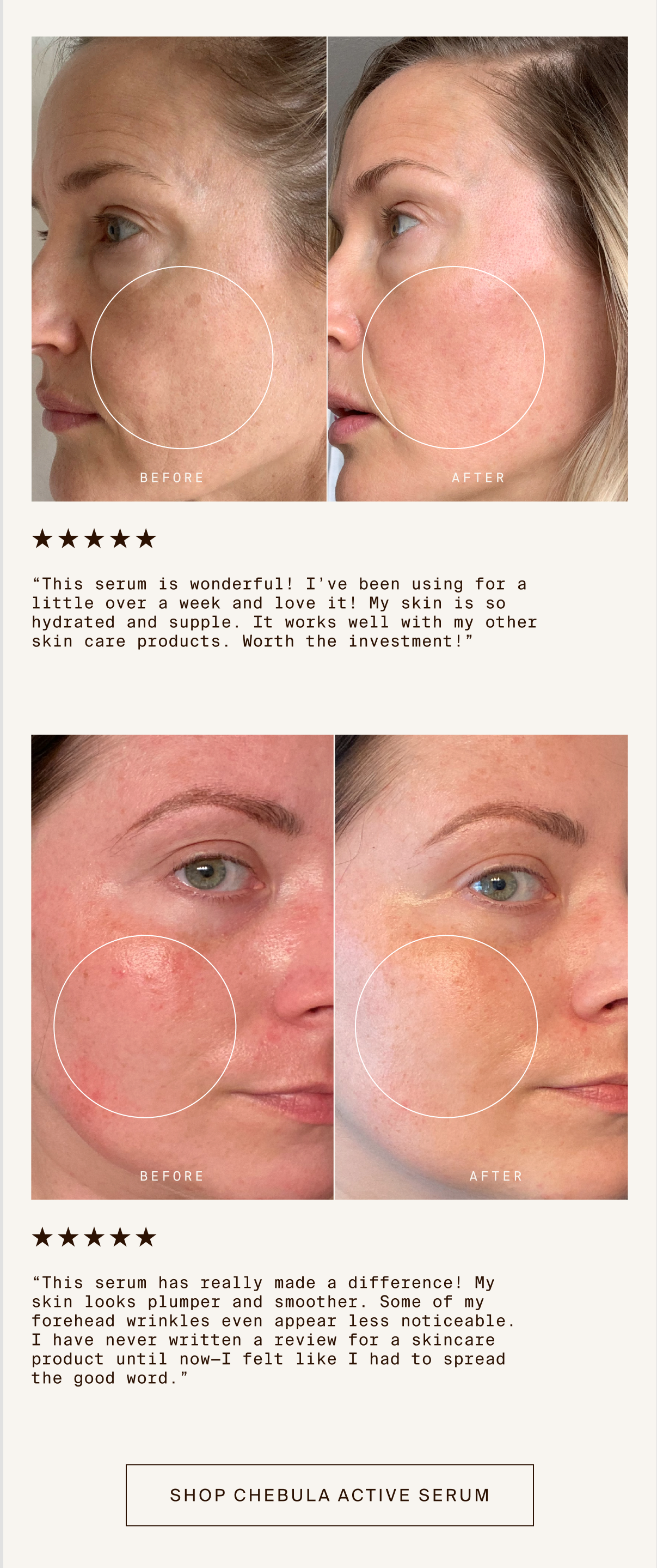 Before & Afters