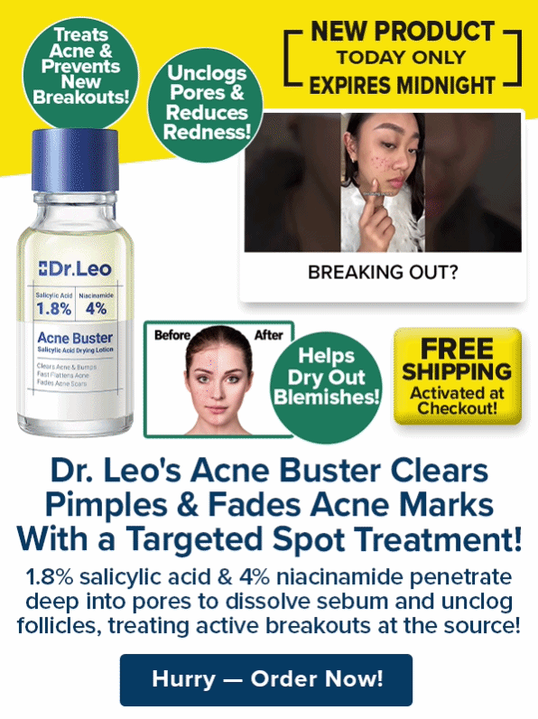 Dr. Leo's Acne Buster Clears Pimples & Fades Acne Marks With a Targeted Spot Treatment!