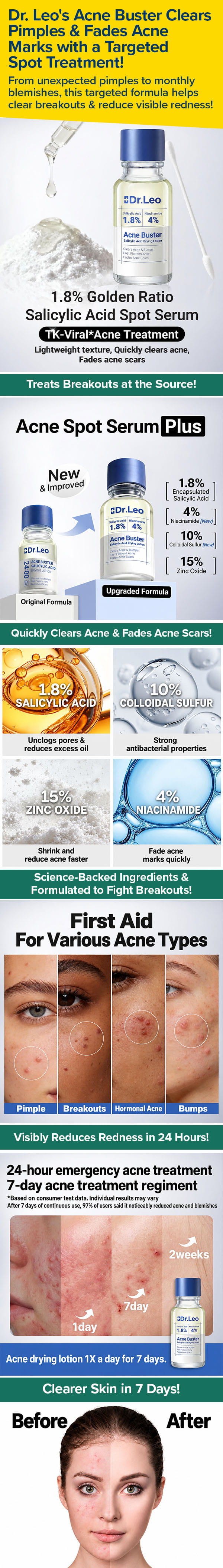 Targets Breakouts at the Source by Unclogging Pores & Clearing Excess Oil!