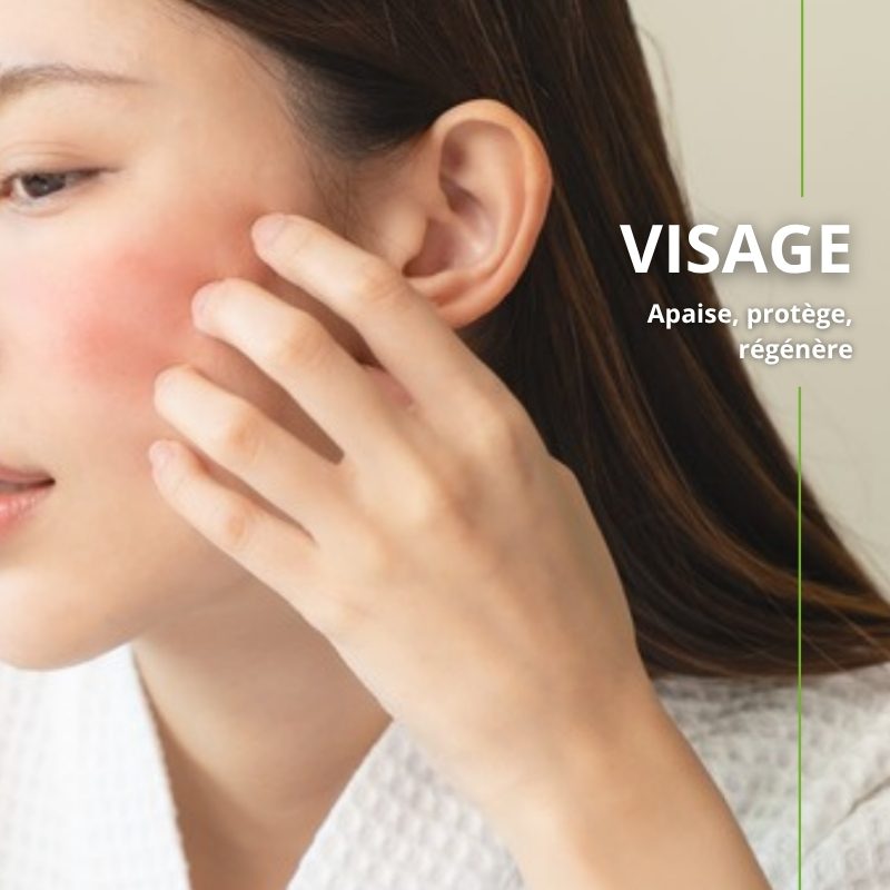 Peau sensible apaisée avec l'huile de chanvre bio Naturoleum