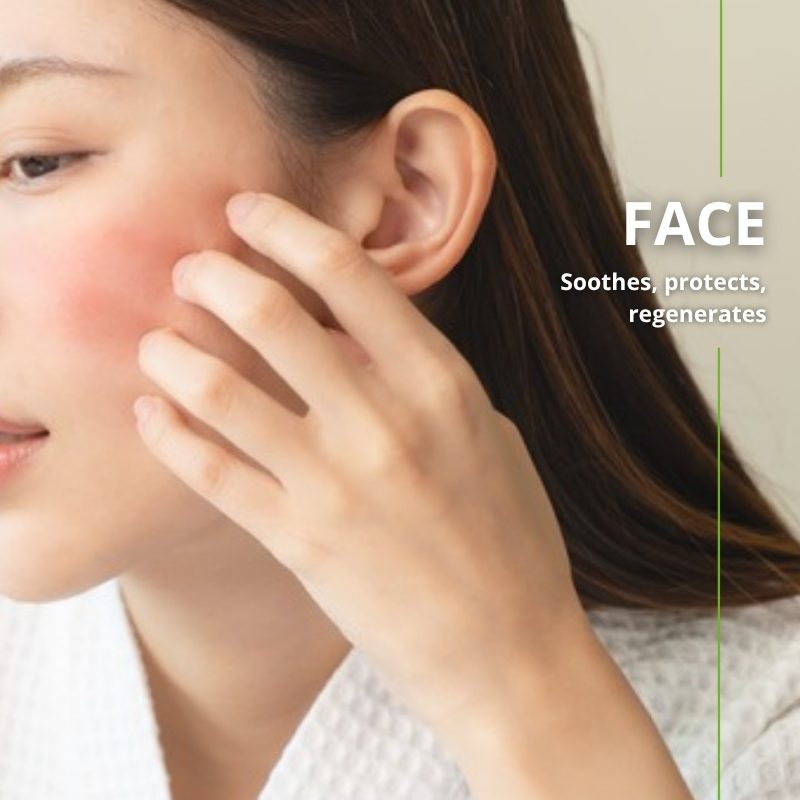 Sensitive skin soothed with Naturoleum organic hemp oil