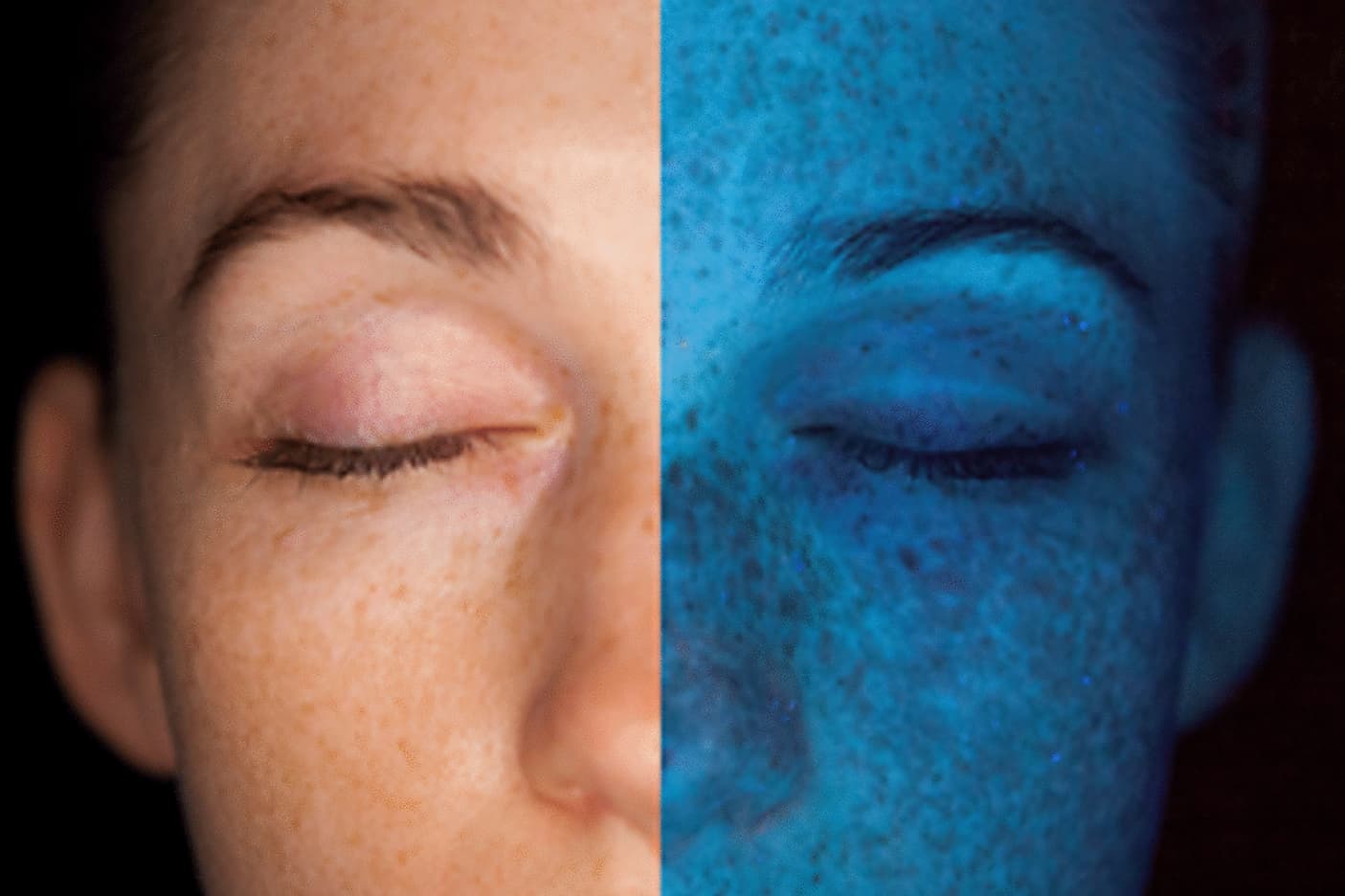 Side-by-side comparison of a woman's face under natural light and blue UV illumination, revealing pigmentation and skin concerns highlighted by SkinCeuticals SkinScope technology. Fearrington Village.