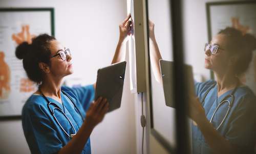 This Unexpected Pattern Could Change How We View Stroke Recovery