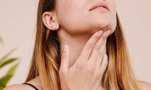 Over 200,000+ Adults Revealed This Connection Between Acne & Diet