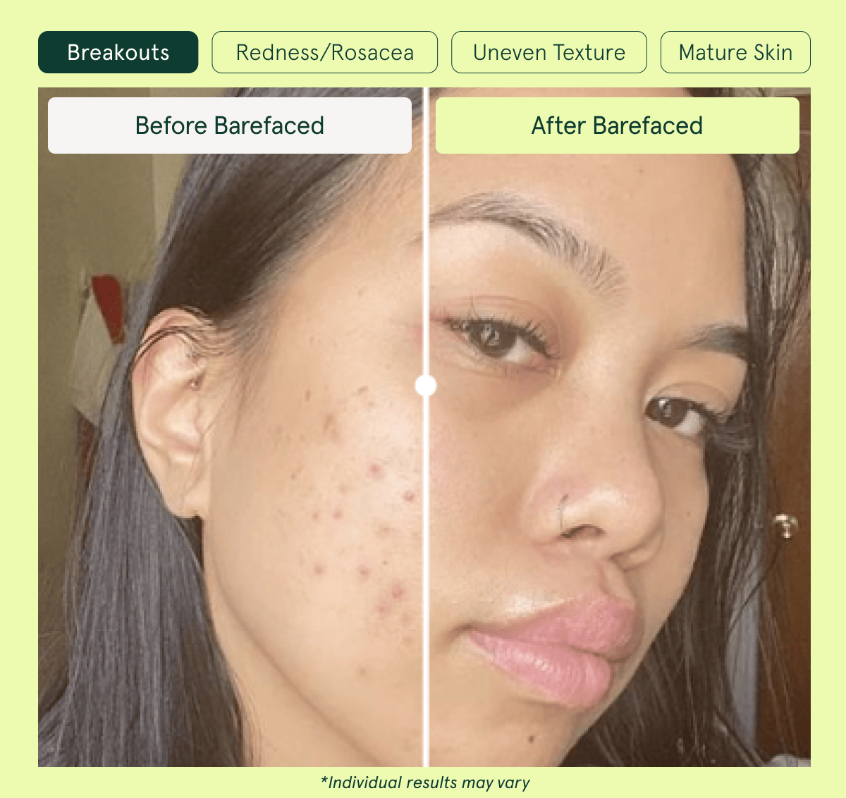 Before and After