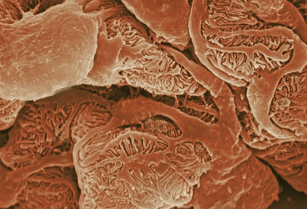 Colorized microscope image showing clusters of folded, textured cells with intricate internal structures.