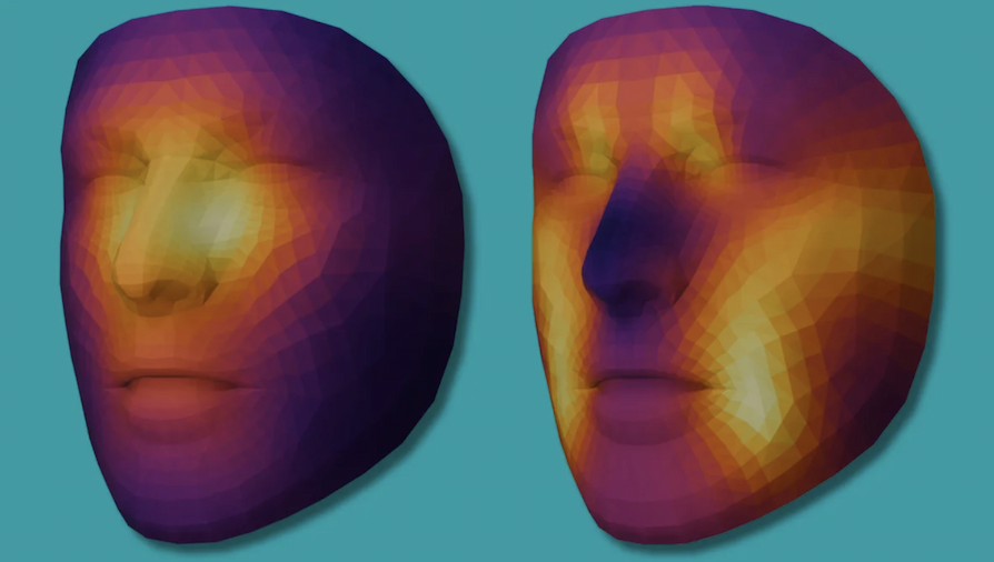 Two color-coded 3D facial models show a distorted human face from front and side views, highlighting variations in facial shape.