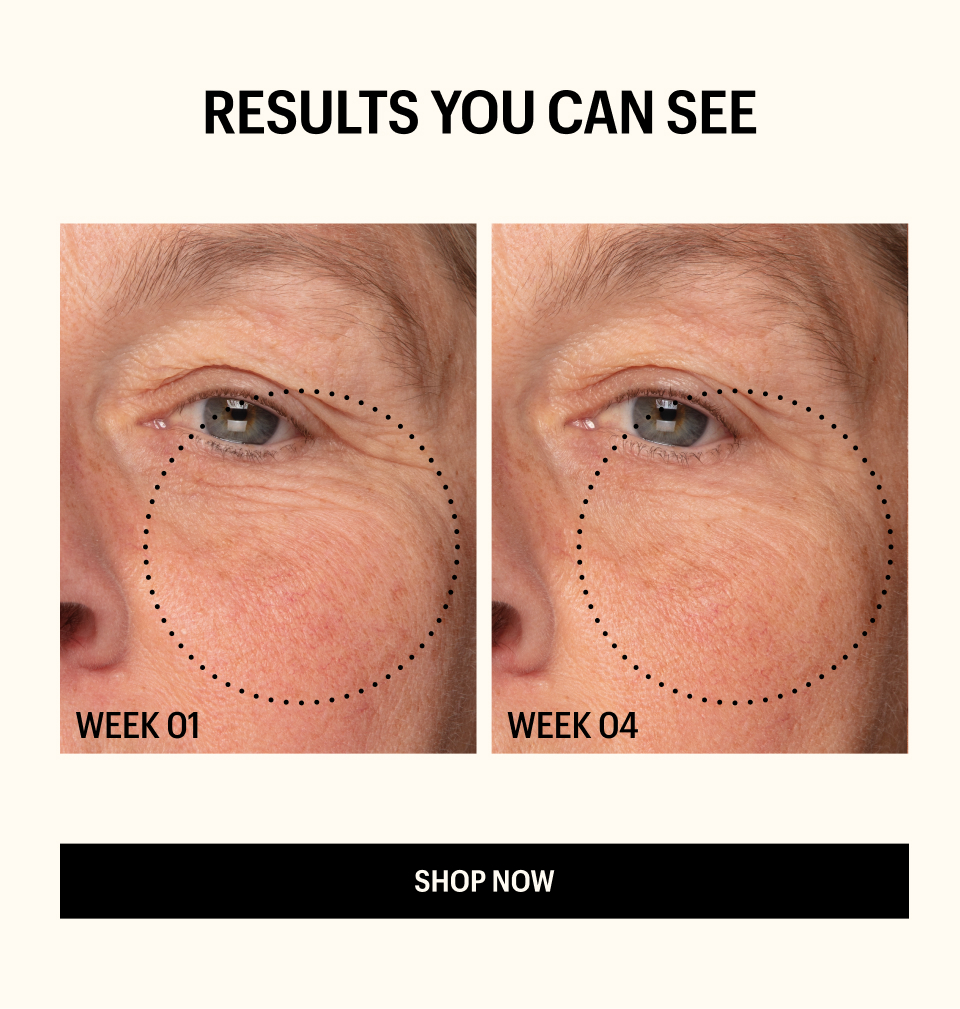 RESULTS YOU CAN SEE