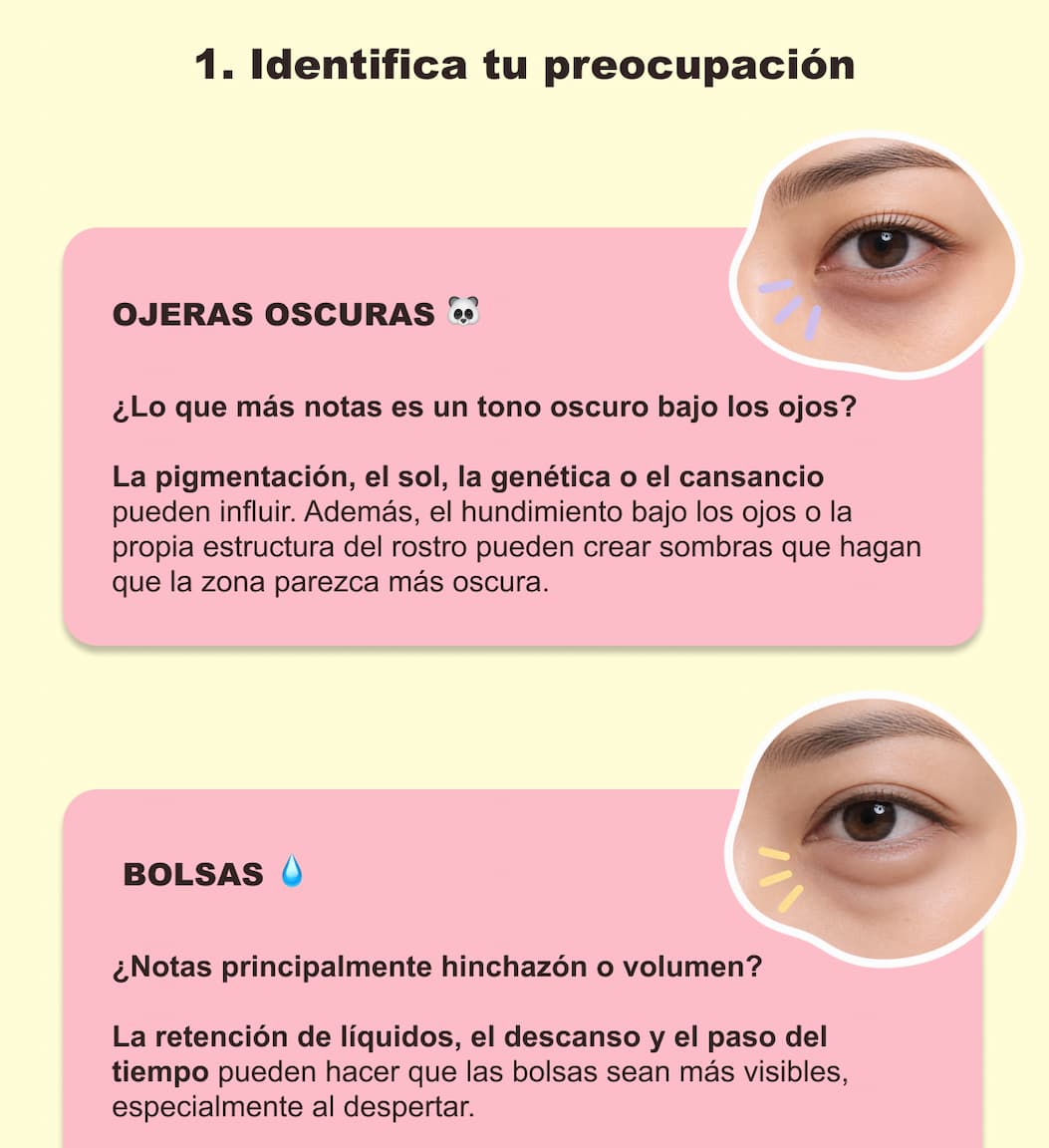 ¿Ojeras oscuras, bolsas o arrugas? ¿Qué necesita tu contorno? — 4