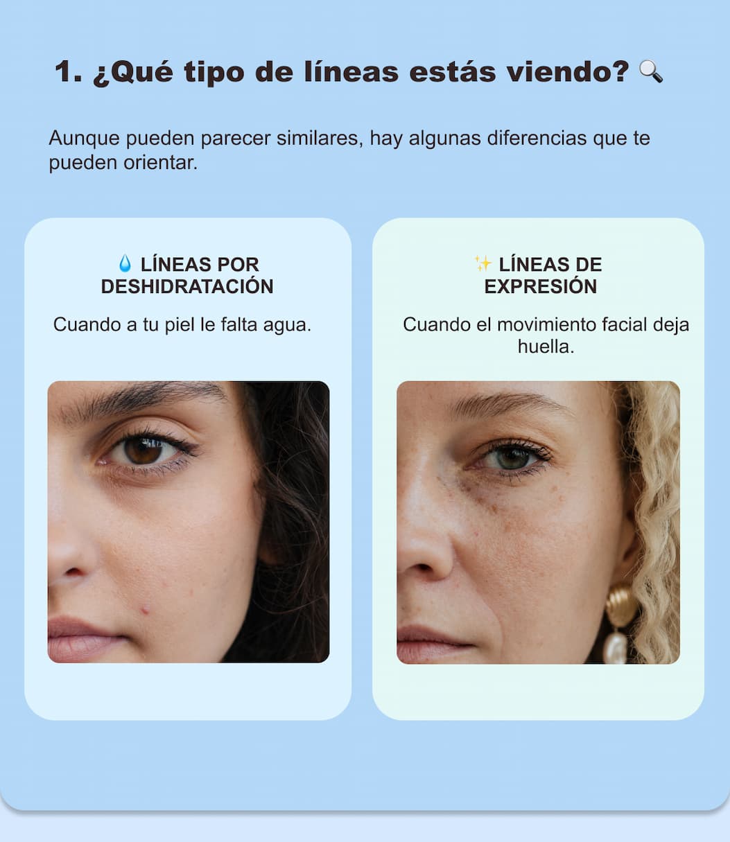 ¿Líneas de expresión o deshidratación? — 3