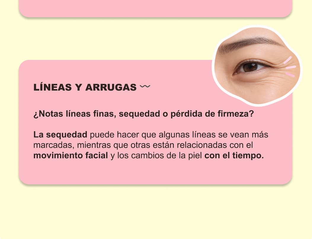 ¿Ojeras oscuras, bolsas o arrugas? ¿Qué necesita tu contorno? — 5