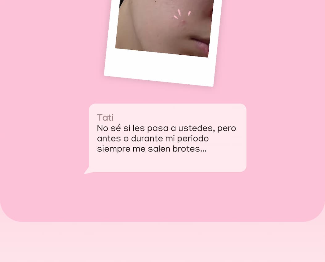 La verdad sobre la piel de Tati — 7