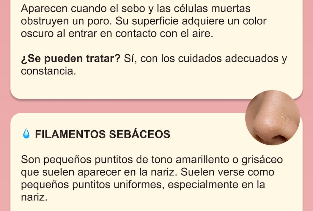 ¿Poros dilatados o puntos negros? — 4